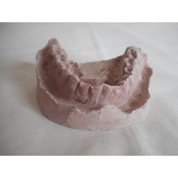Vintage Cast Dental Teeth Mold  Tooth Castings #9 - Picture 1 of 5